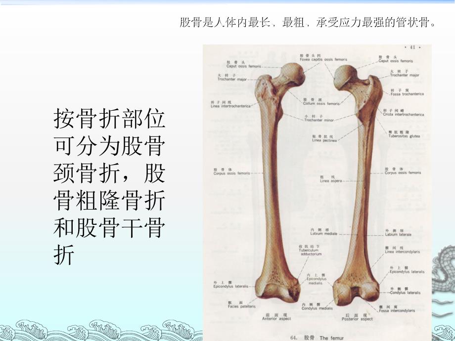 股骨骨折护理ppt课件_第3页