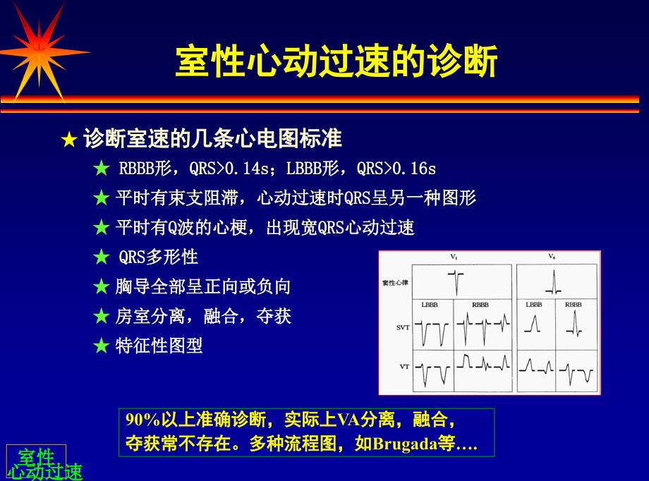 室性心动过速的诊断与治疗深度分析_第4页