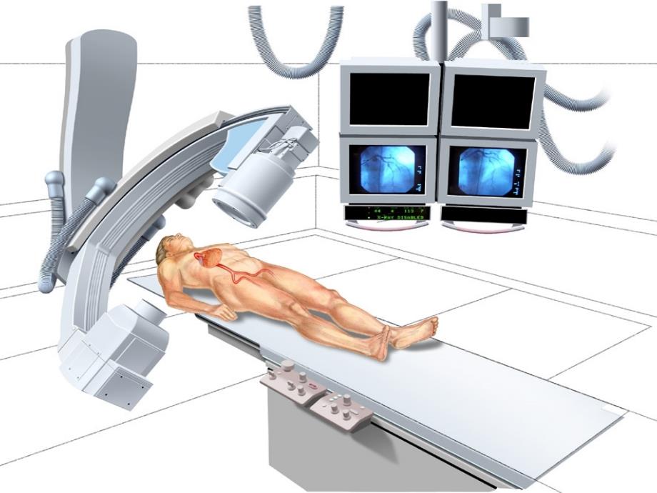 PCI手术操作步骤课件_第3页