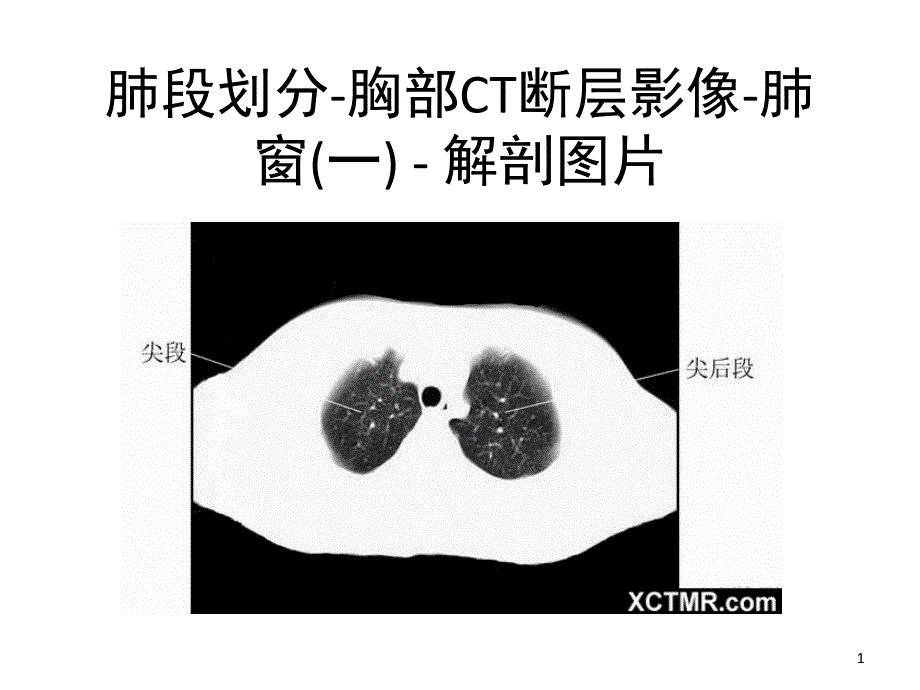 胸部CT肺段划分课堂PPT_第1页