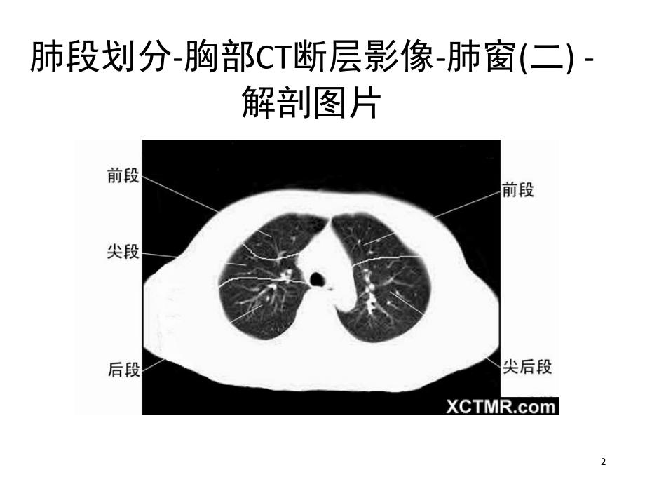 胸部CT肺段划分课堂PPT_第2页