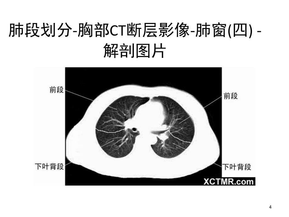 胸部CT肺段划分课堂PPT_第4页