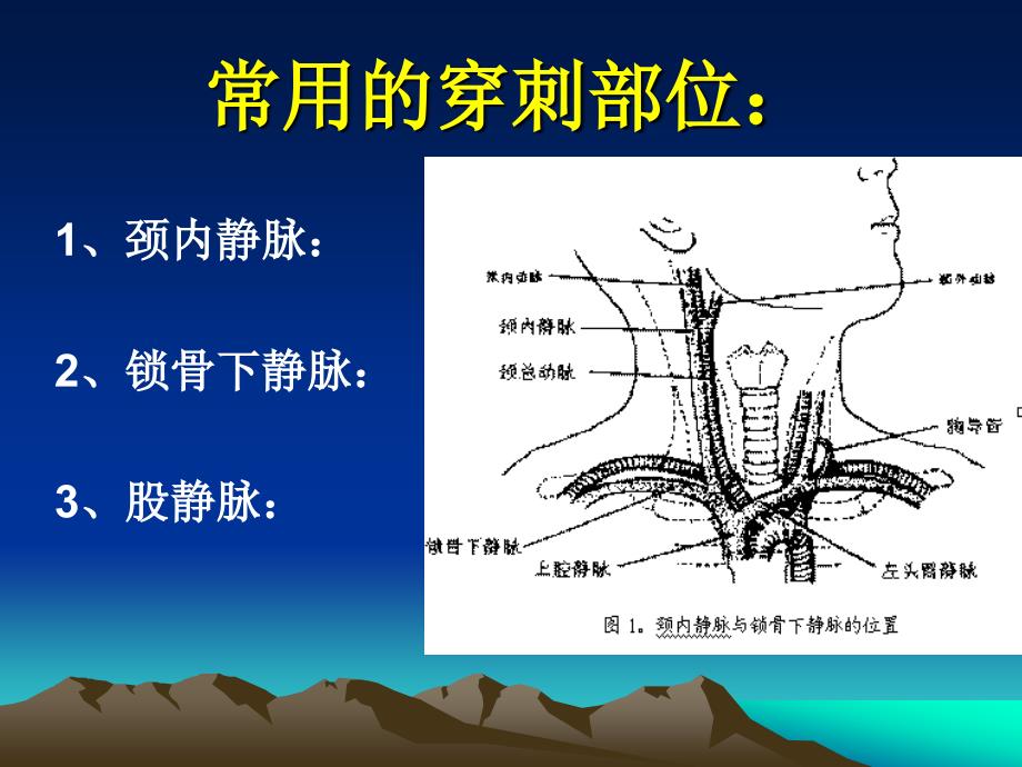 中心静脉压(CVP)监测及波形分析通用课件_第4页