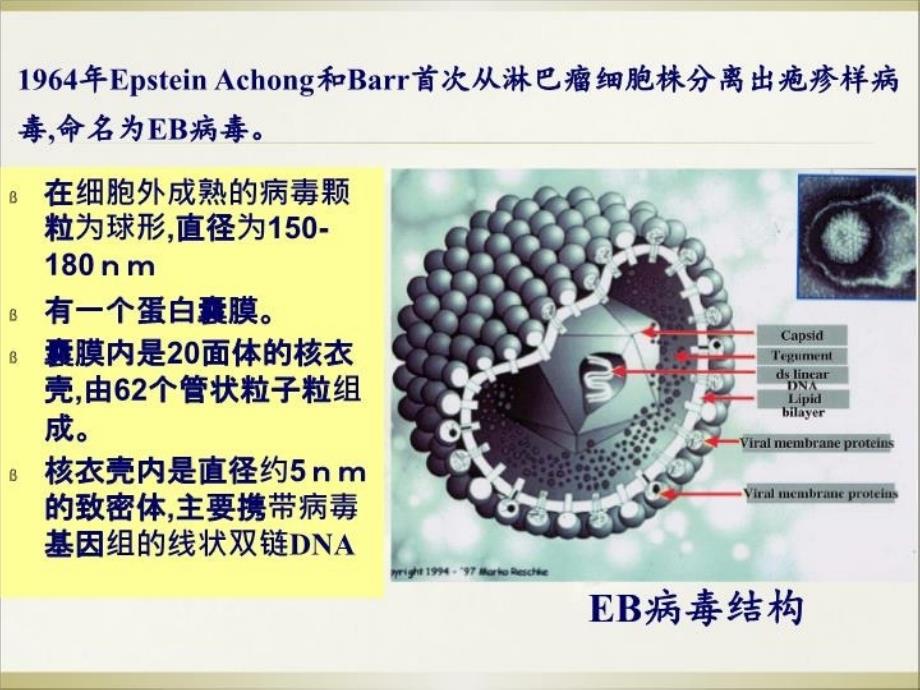 EBV病毒讲课教学文案_第4页