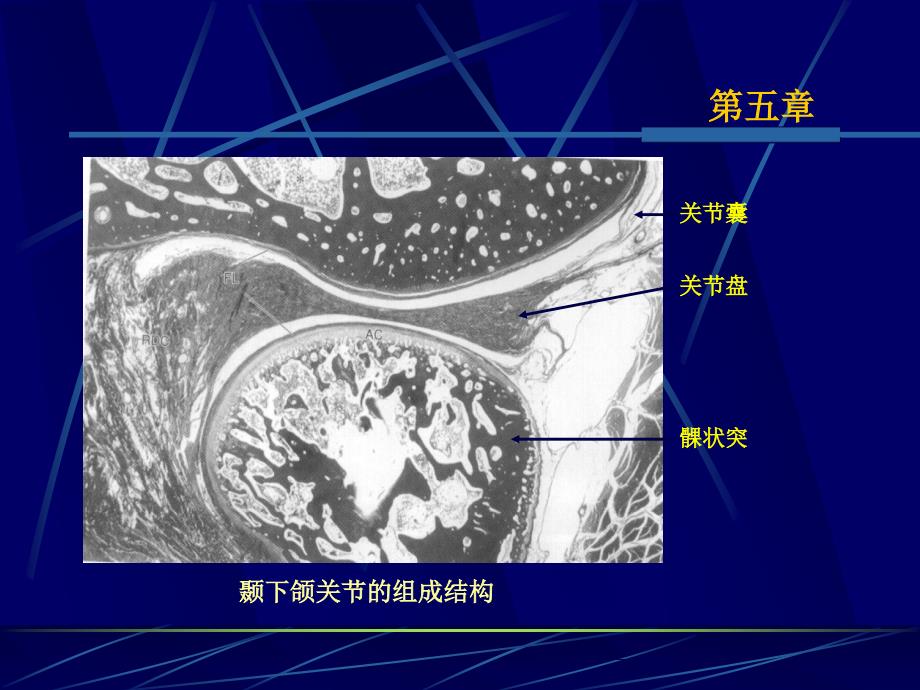 第五章颞下颌关节_第3页