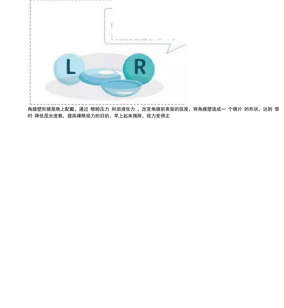 一文带你了解!普通框架眼镜、角膜塑形镜(OK镜)、近视离焦眼镜的区别_第3页