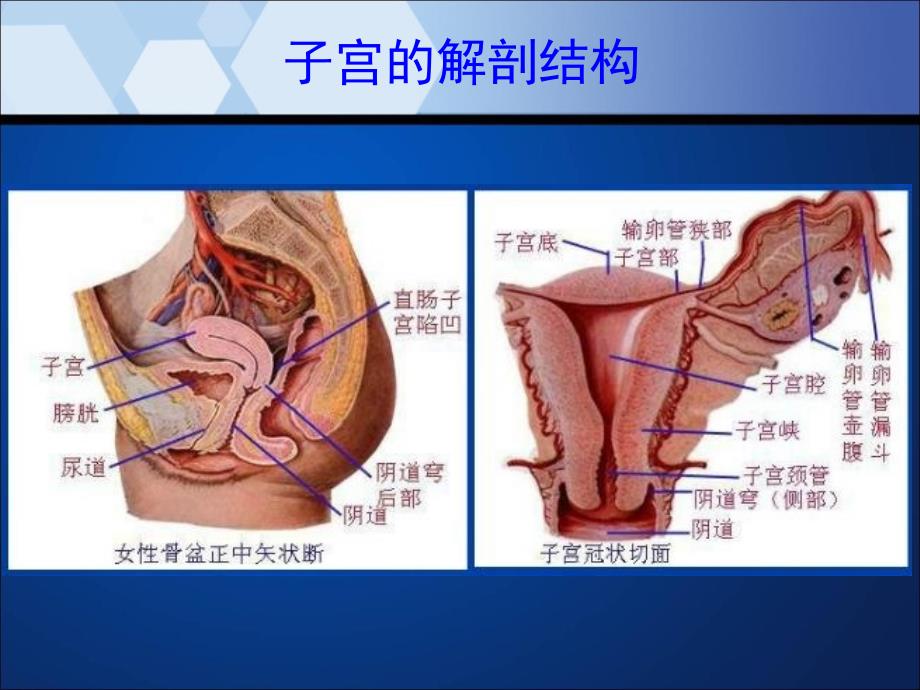 子宫内膜癌MRI影像表现_第4页