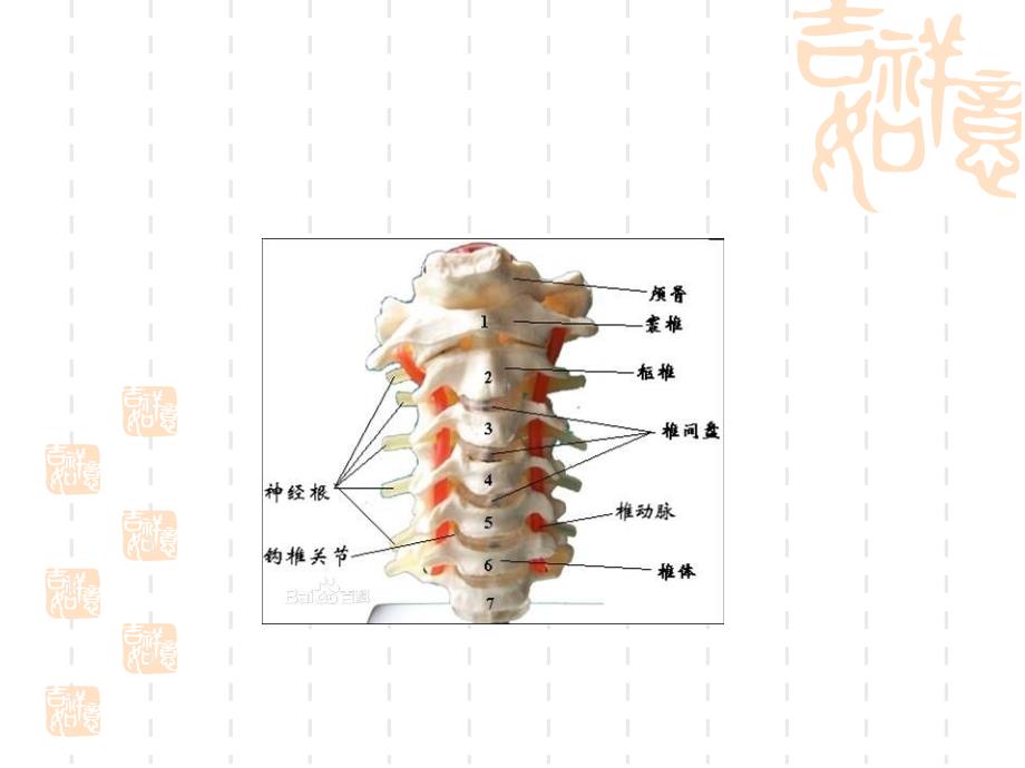 颈椎骨折病人的护理_第3页