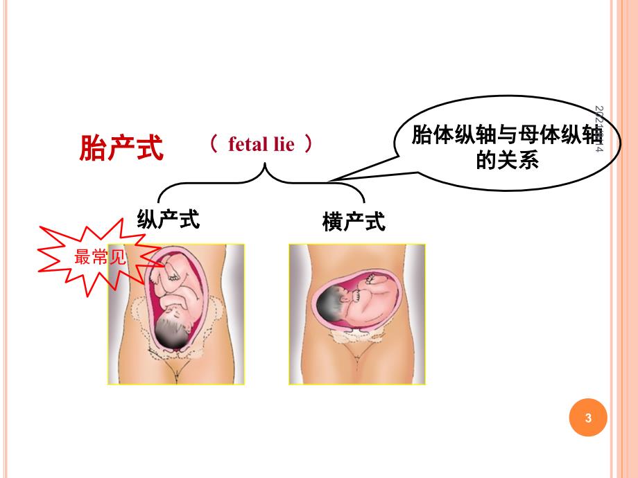 产科四部触诊_第3页