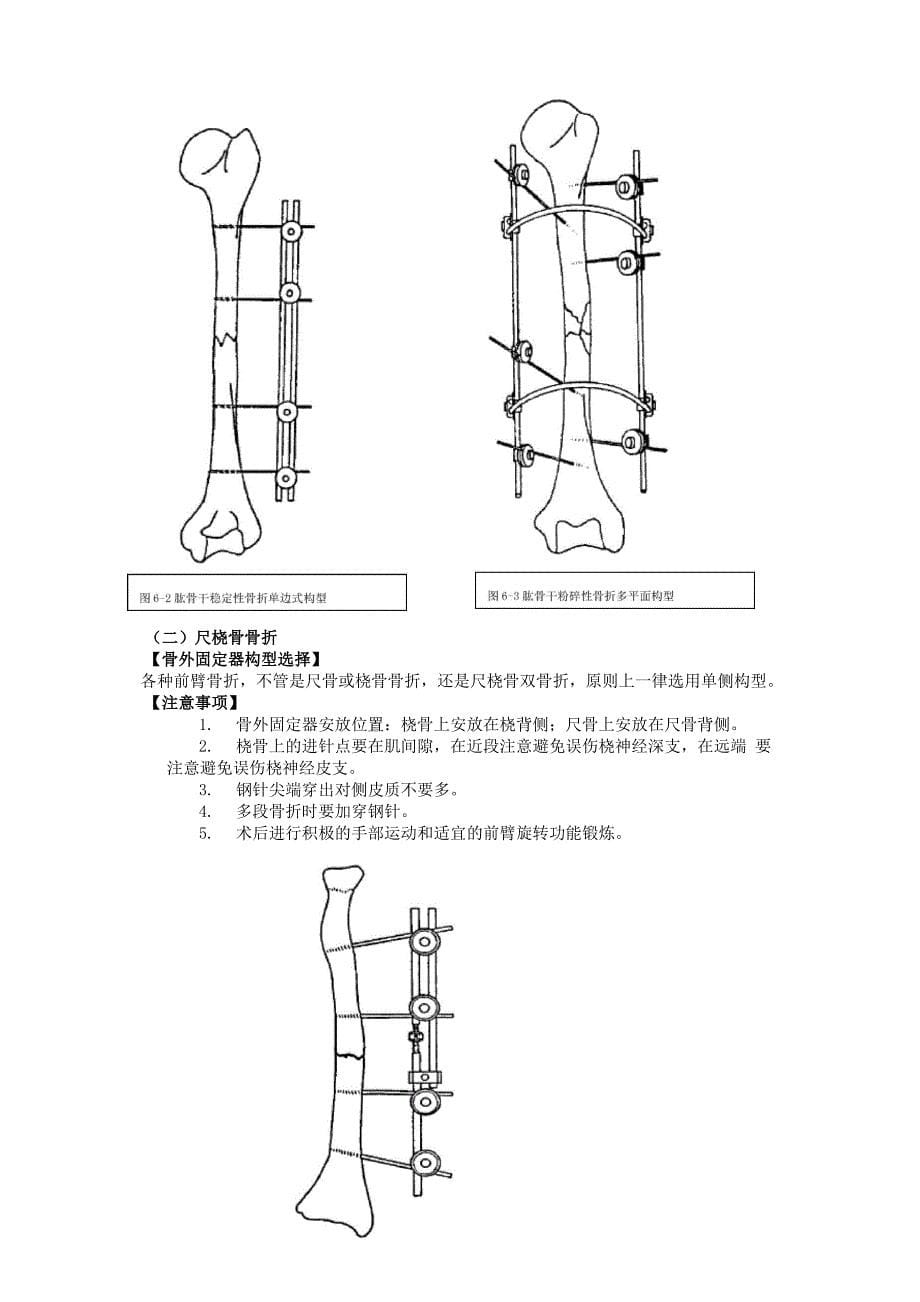 骨外固定支架治疗四肢骨折技术_第5页