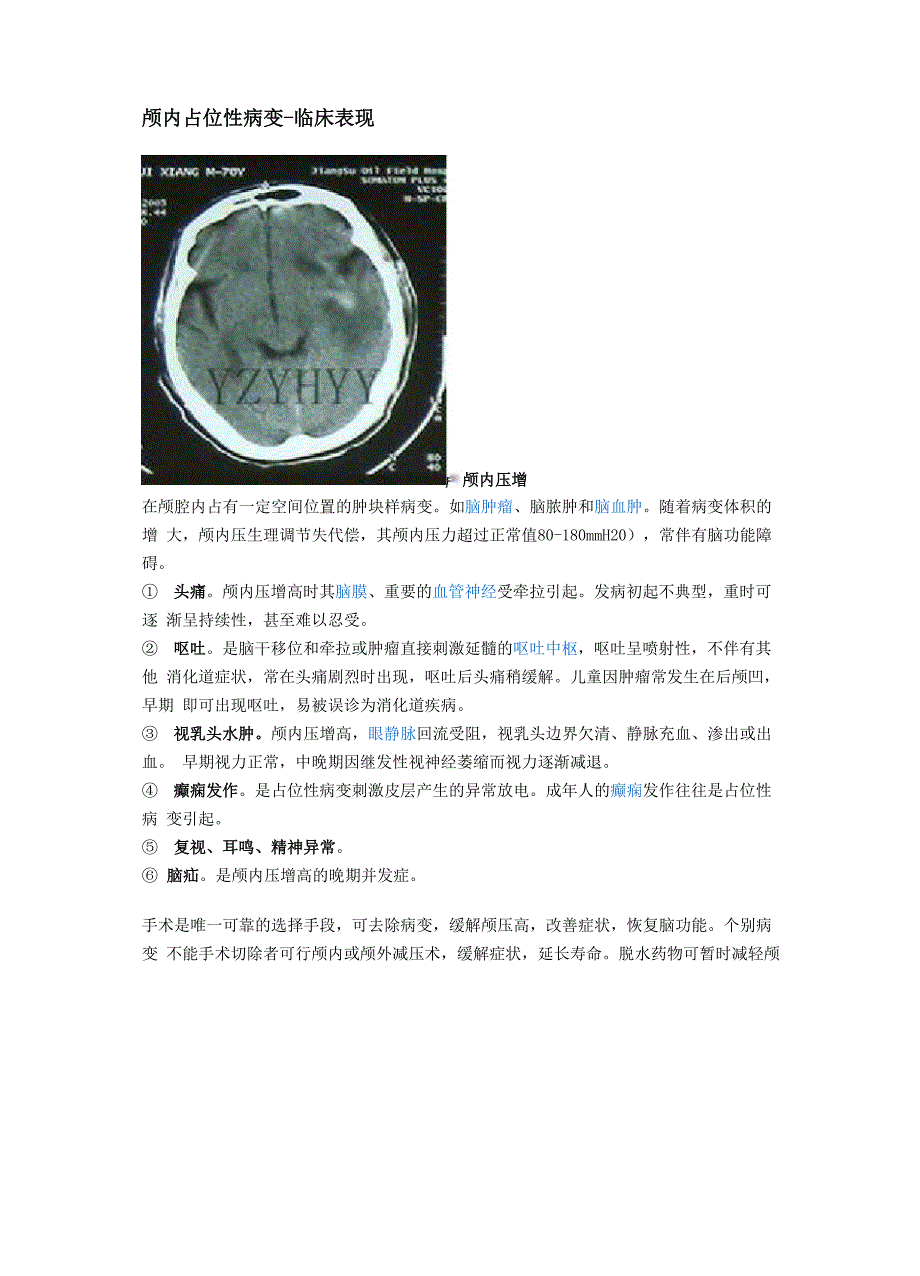 颅内占位性病变_第2页