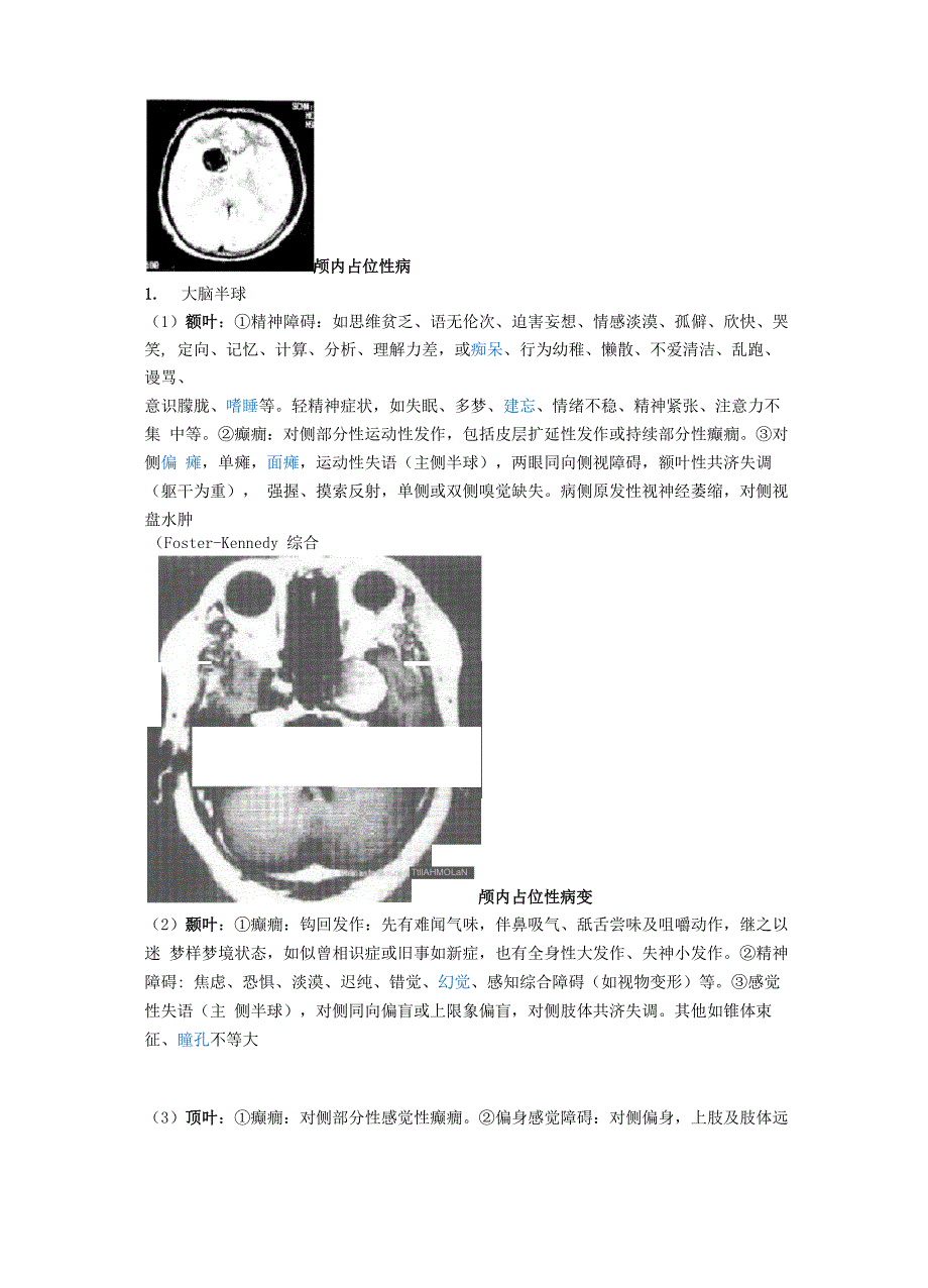 颅内占位性病变_第4页