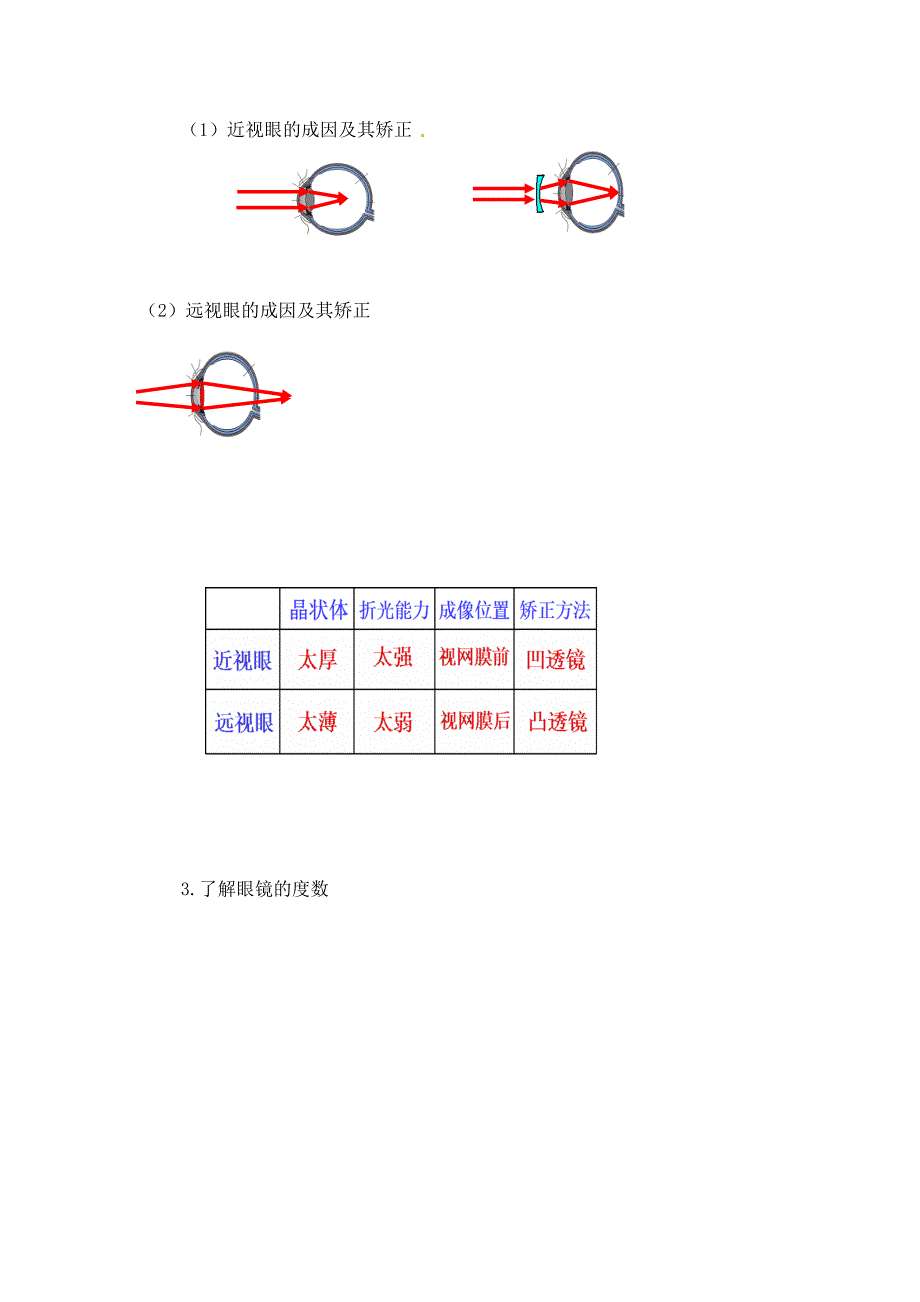 内蒙古准格尔旗第十中学八年级物理上册5.4眼睛和眼镜导学案无答案新版新人教版_第2页