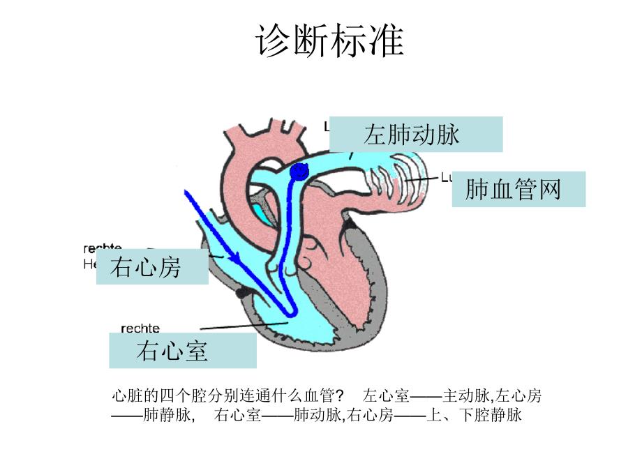 肺动脉高压查房_第4页