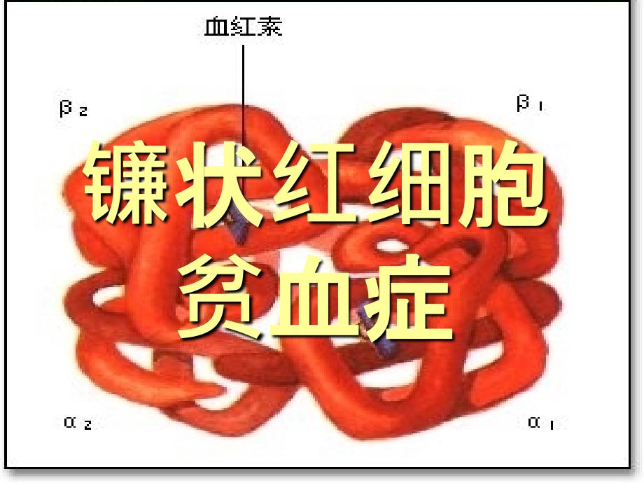 血液生化镰状红细胞贫血_第1页
