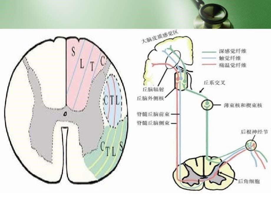 神经系统体格检查感觉运动部分_第5页