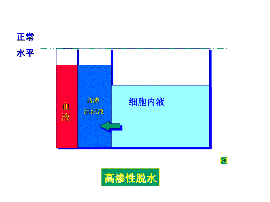 病理生理学课件：水电解质2_第3页