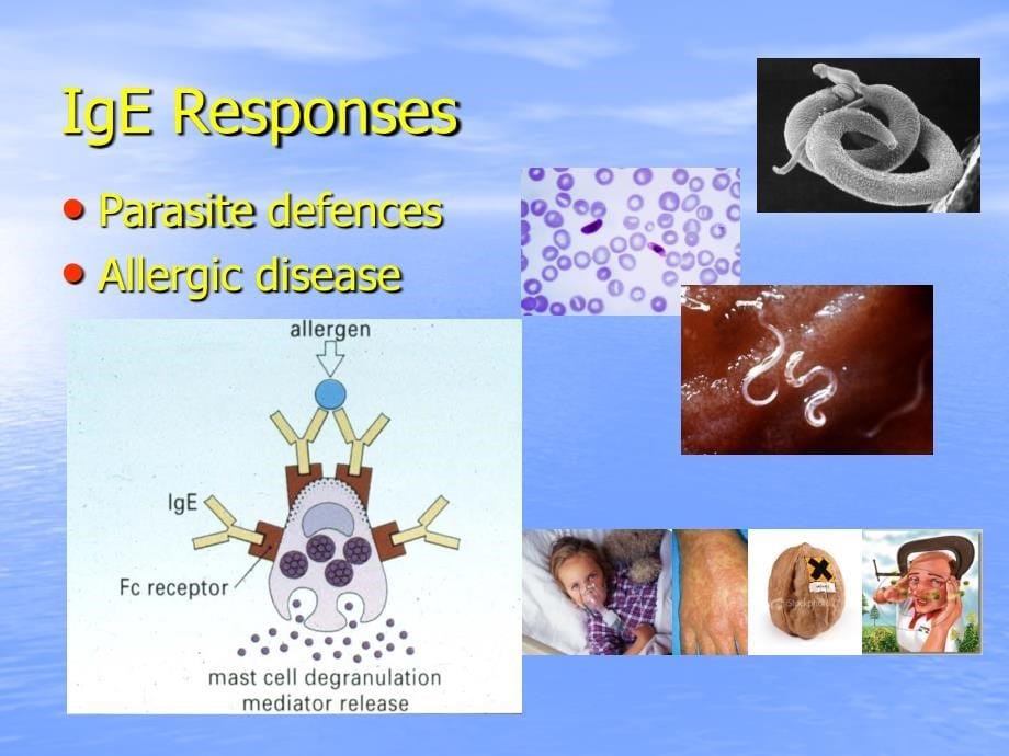 AllergicDiseasefinal过敏性疾病与抗体_第5页