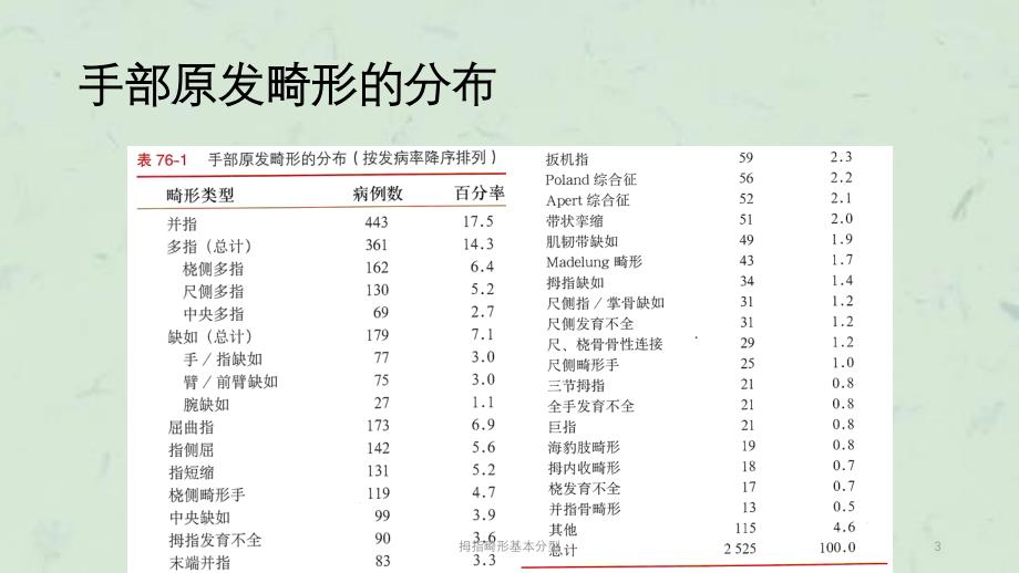 拇指畸形基本分型课件_第3页