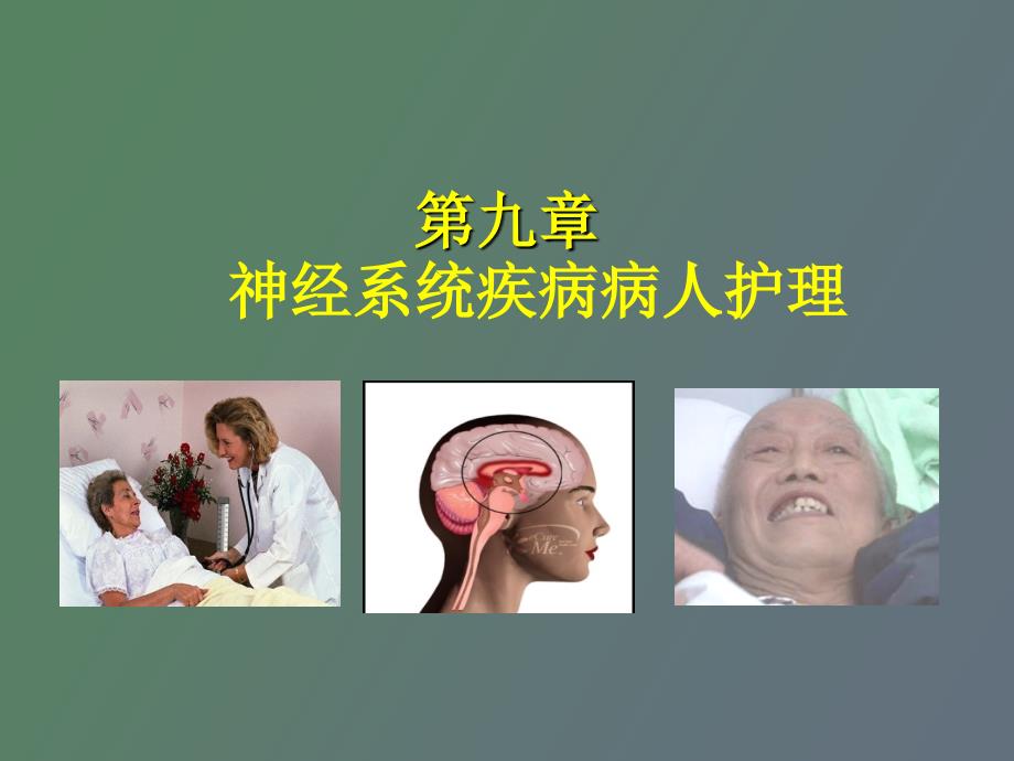 急性脑血管疾病出血性_第1页