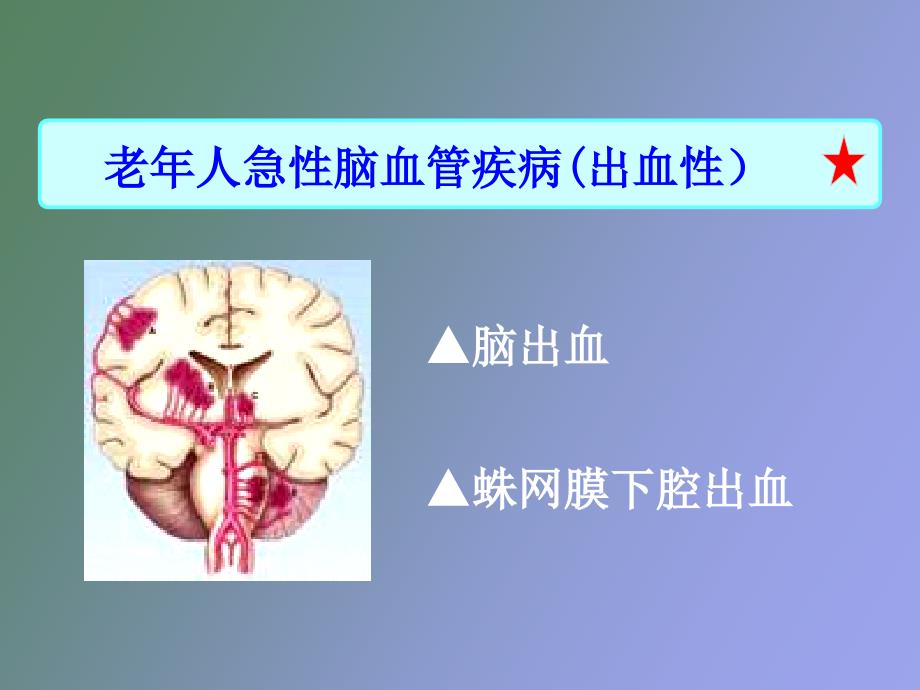 急性脑血管疾病出血性_第2页