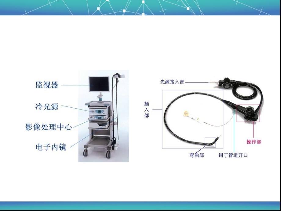 消化内镜操作、诊断及治疗_第4页