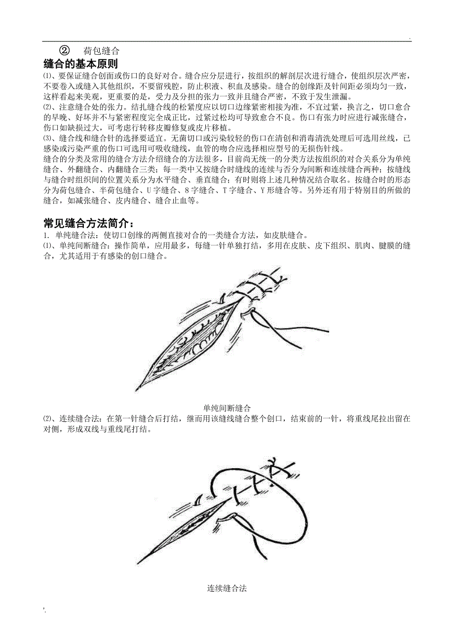 《外科手术缝合方法图解》_第2页