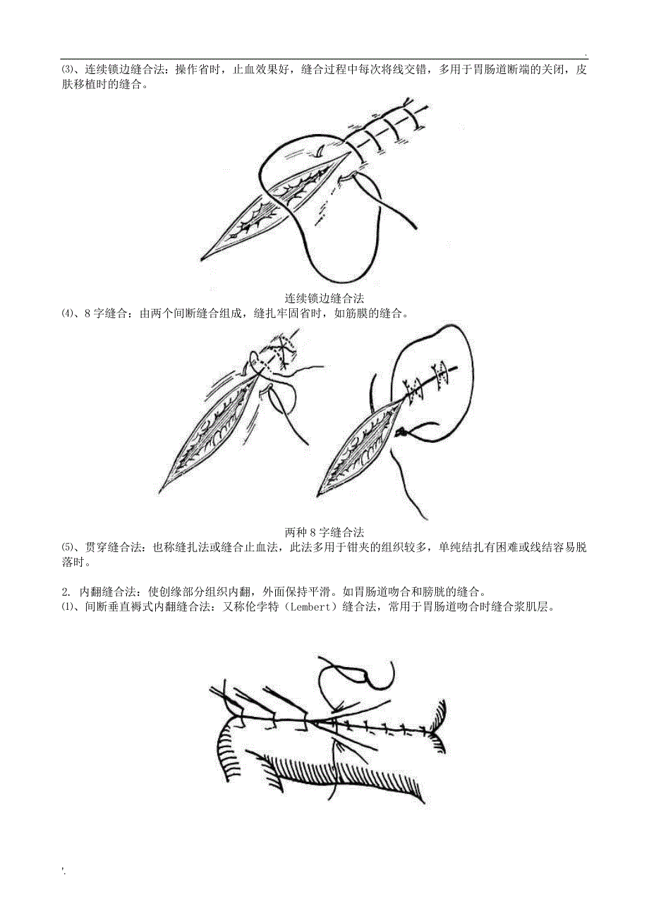 《外科手术缝合方法图解》_第3页