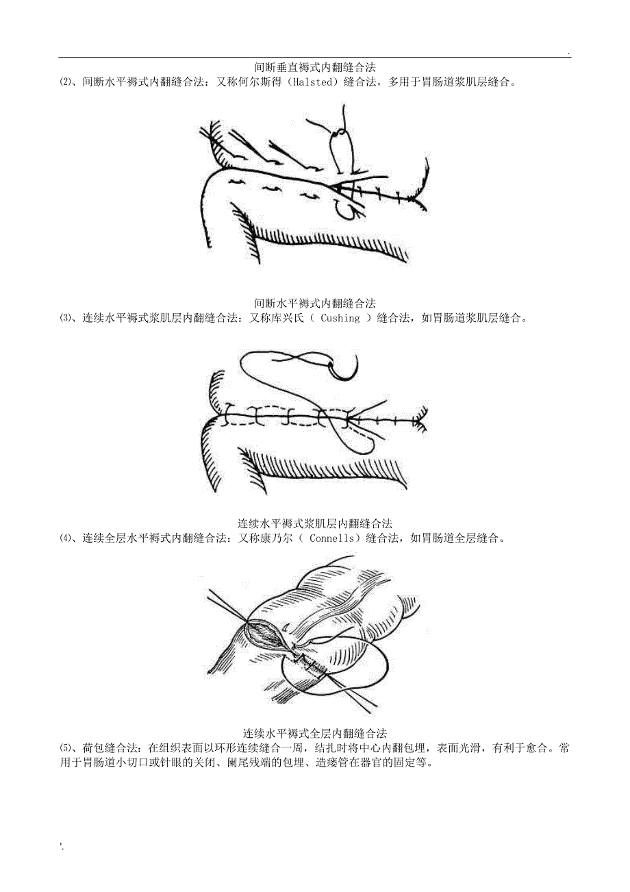 《外科手术缝合方法图解》_第4页