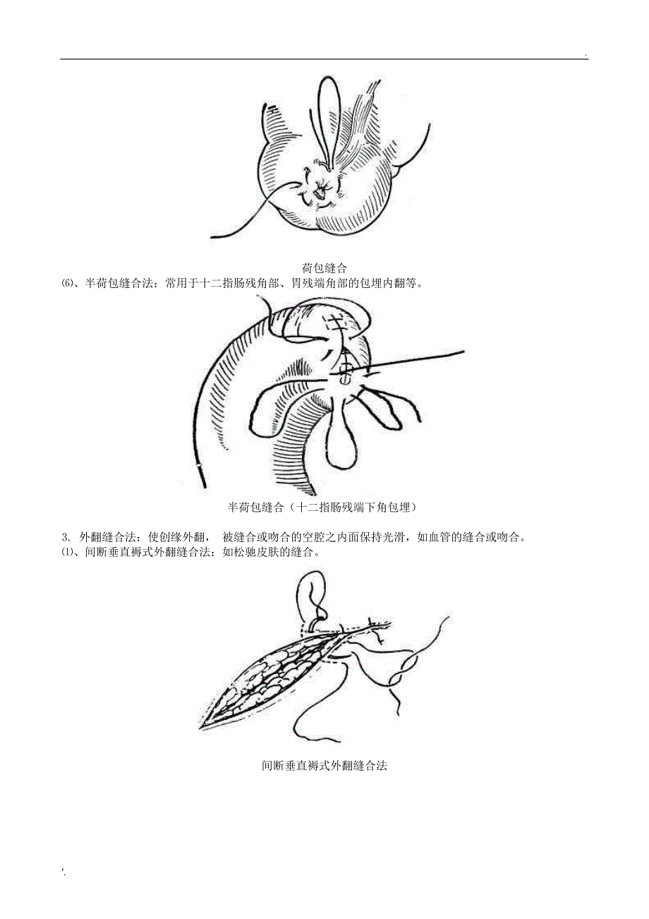《外科手术缝合方法图解》_第5页