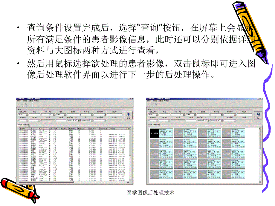 最新医学图像后处理技术PPT_第3页