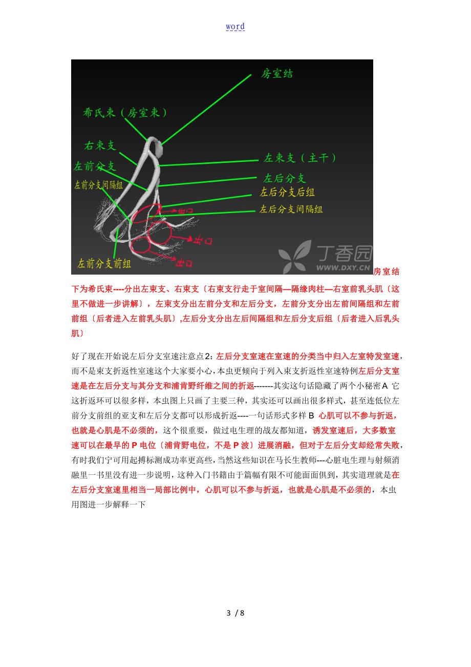 这是个左后分支室速地心电图_第3页