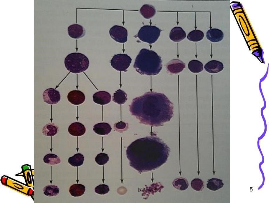 急性早幼粒细胞白血病医术材料_第5页