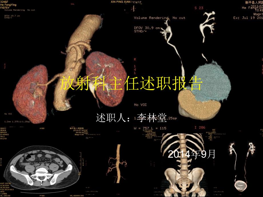 放射科主任述职报告_第1页