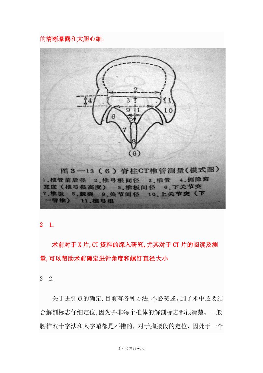 精品脊椎椎弓根钉进钉点的确定及手术技巧_第2页