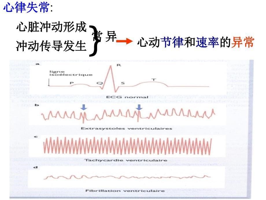 第19章 抗心律失常药_第5页