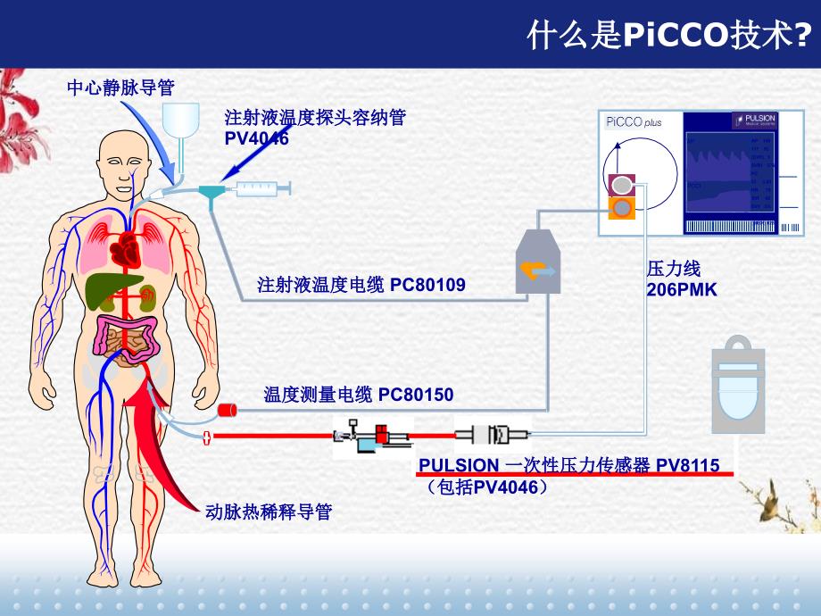 iCCO临床价值以及护理_第5页