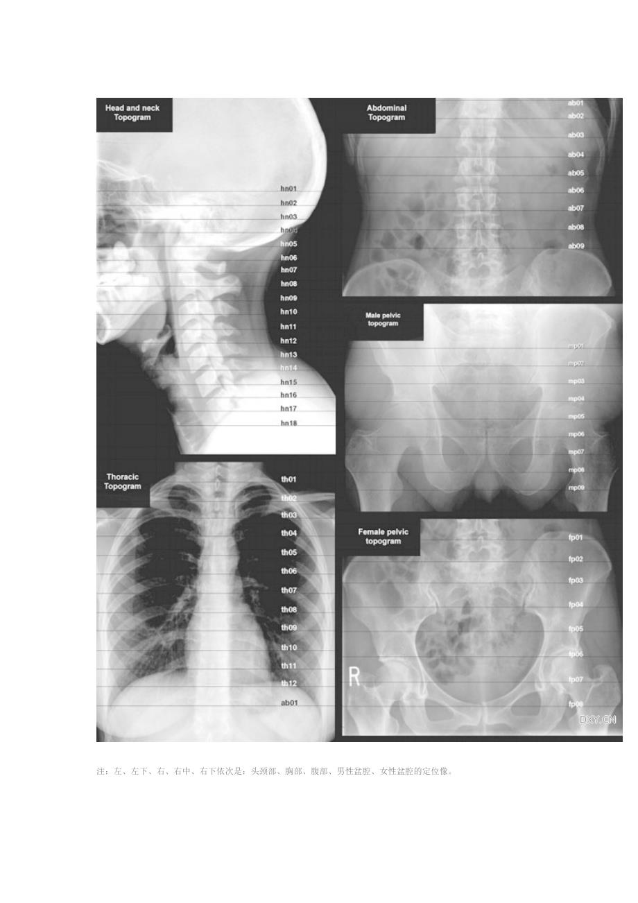 经典：全身淋巴结分区 CT 图谱.doc_第2页