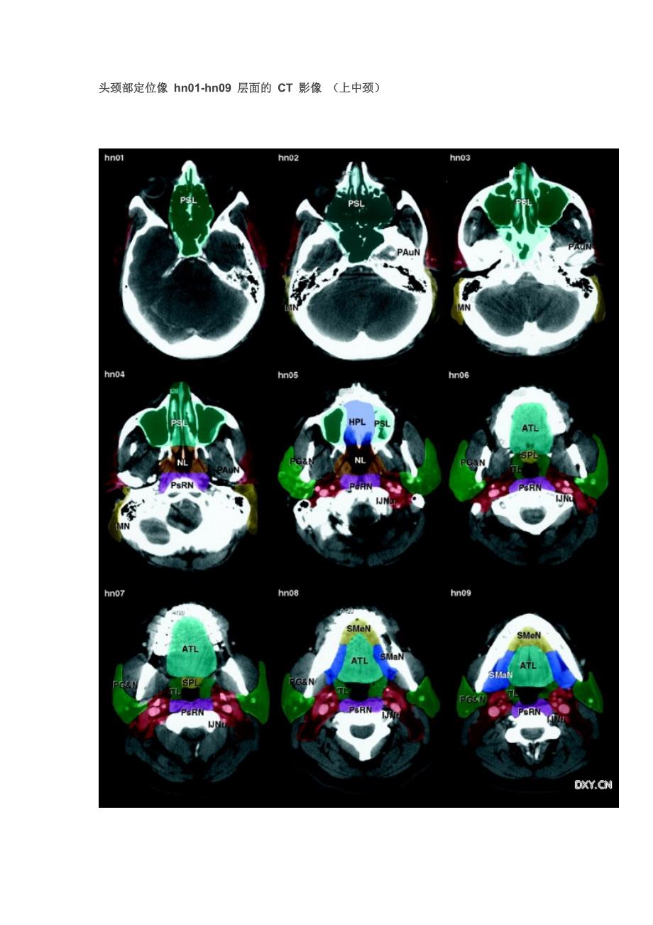 经典：全身淋巴结分区 CT 图谱.doc_第3页