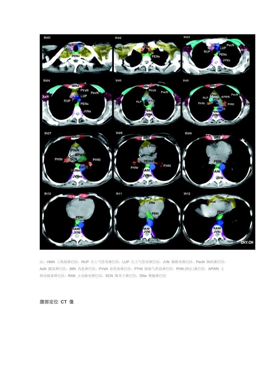 经典：全身淋巴结分区 CT 图谱.doc_第5页