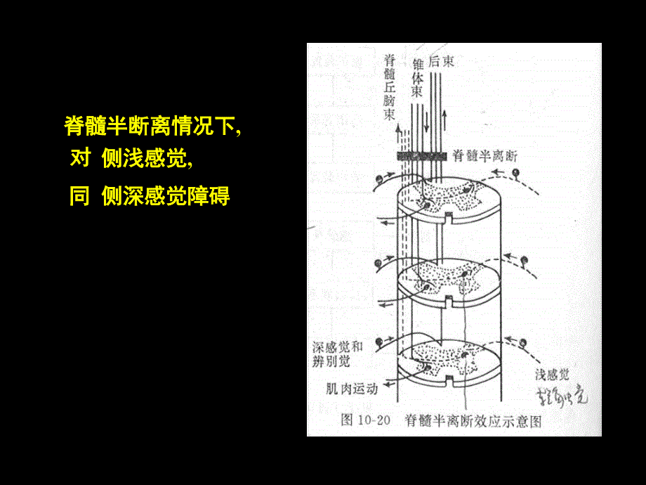 神经系统二PPT课件_第4页