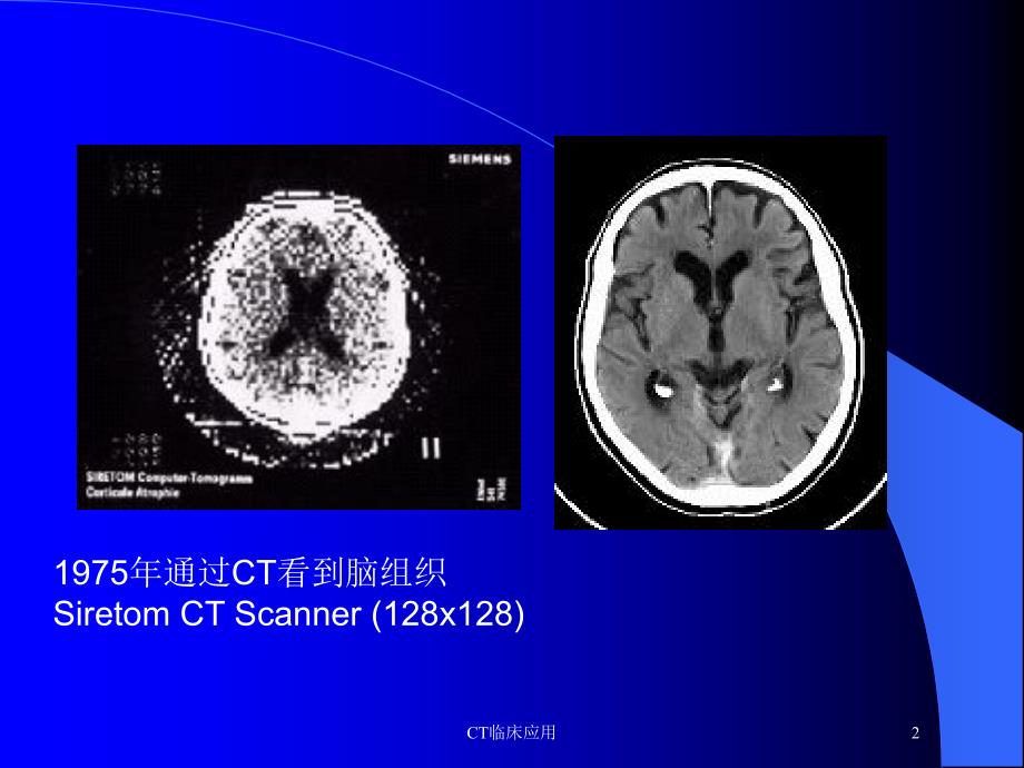 CT临床应用培训课件_第2页