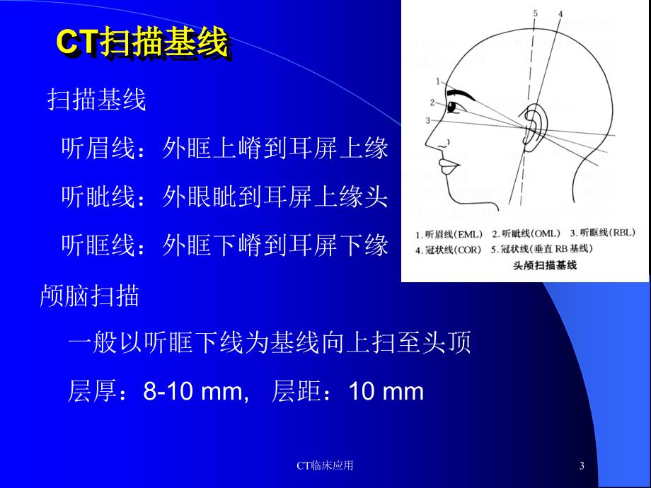 CT临床应用培训课件_第3页