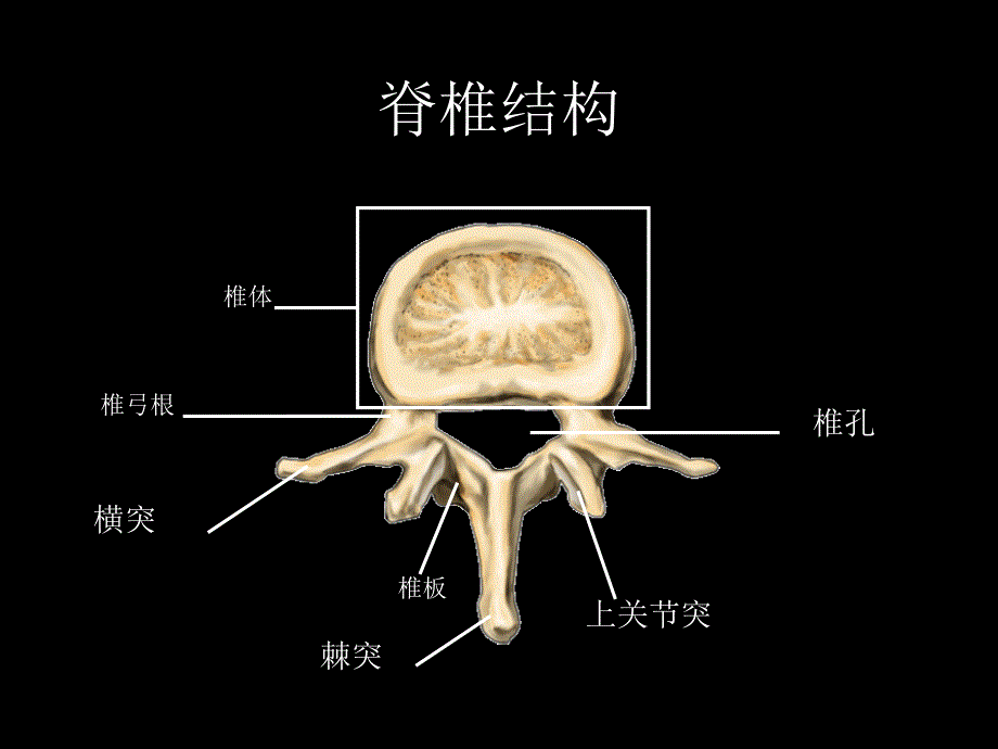 椎体成形术课件.ppt_第4页