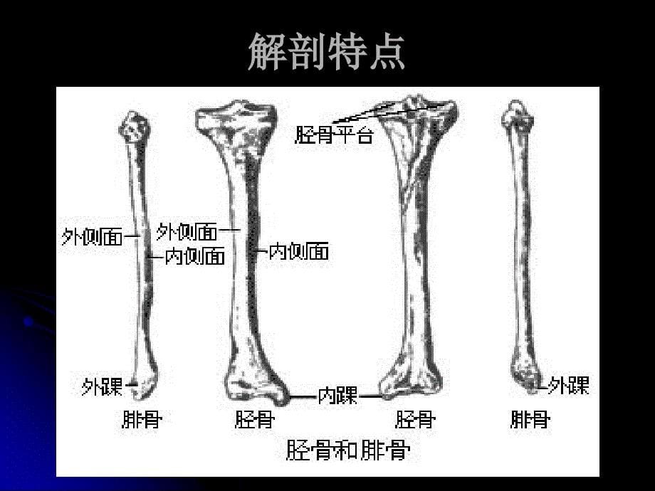 下肢骨折3ppt课件_第5页