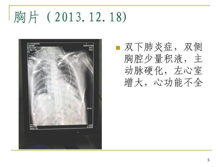 ICU多重耐药菌_第5页