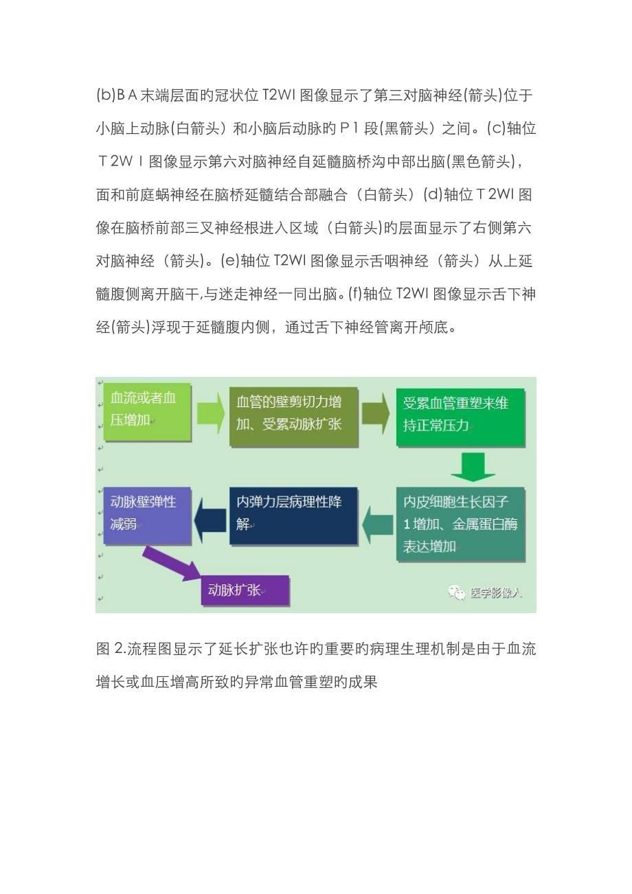 基底动脉延长扩张症_第5页