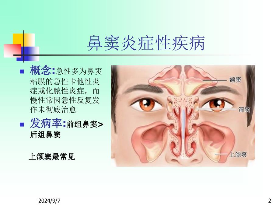 耳鼻咽喉头颈外科学二急慢性鼻窦炎_第2页