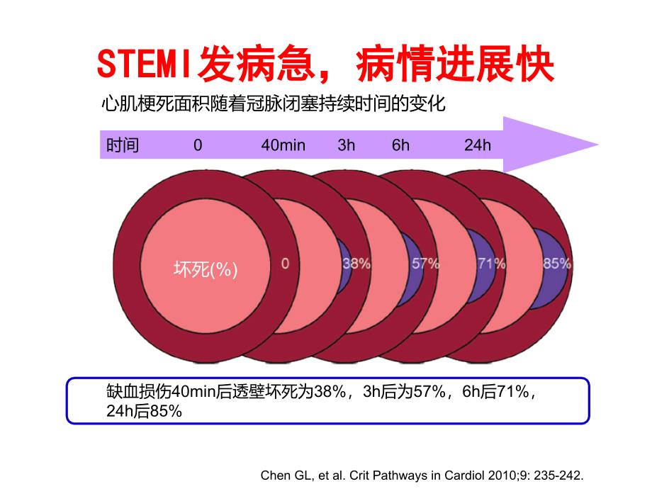 急性ST段抬高心肌梗死管理指南医疗系统的救治反应_第3页