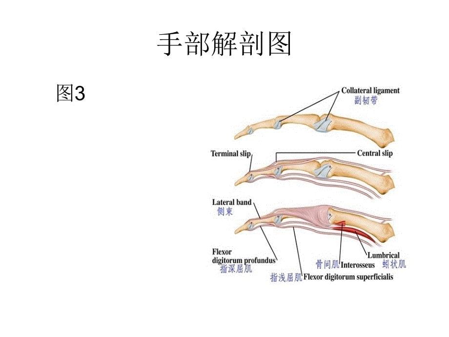 手外伤的护理课件_第5页